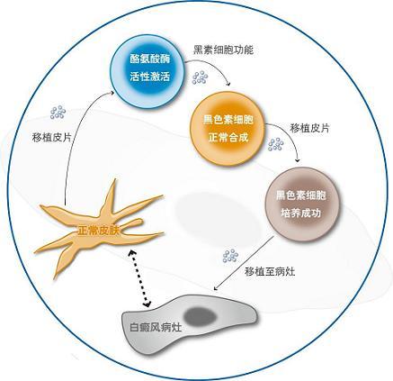 黑色素脱失怎么补回来